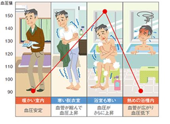 図1:温度差によって変動する血圧イメージ